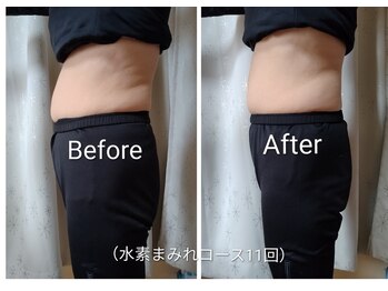 ヨサパーク ラク(YOSA PARK RAKU)の写真/食べるの大好き運動苦手な貴女も！頑張りすぎないダイエットで痩せやすい土台つくりをサポート♪