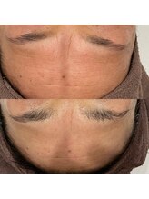 ギャラクシービューティー(galaxy beauty)/