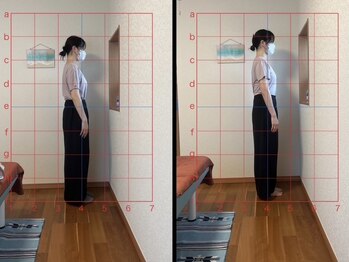 アロハ(ALOHA)/産後整体/骨盤矯正