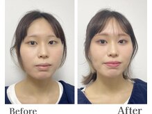 ルネカラー(Renecolor)/フルメイクレッスンBefore/After