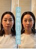 【たるみ/ほうれい線/二重顎改善】小顔整体＋首肩ケア11,000円→5,980円