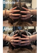 光幸はりきゅう院接骨院/美容鍼で小顔・頭効果☆浦和