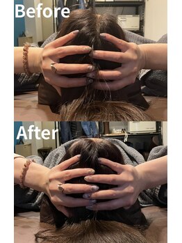 光幸はりきゅう院接骨院/美容鍼で小顔・頭効果☆浦和