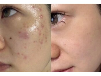 ラポール 野並店(Rapport)/