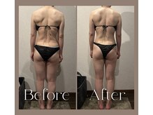 ドゥブレジャンティ(doubler gentil)の雰囲気（【ボディデザイン筋膜リリース】　背中全体が緩み左右差に変化♪）