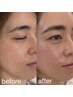 【学割U24】憧れの水光肌に！肌がきれいになるフェイスワックス