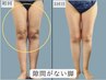 痩身N0２【美脚スリム】むくみ・冷えで太く見える脚をスッキリ引き締め