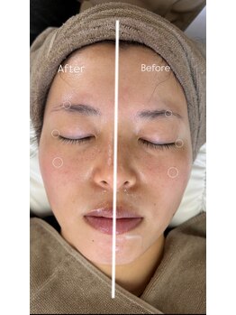 ビアンカ(Bianca)/エステ×まつ毛パーマ