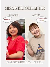 ここてら 浜松佐鳴台院/ホットEMS2ヶ月でー5キロ！