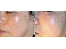 オリエンタルビューティー(ORIENTAL BEAUTY)の雰囲気（シミ/しわ/たるみ/毛穴..年齢肌のお悩みに最大限に効果を発揮）