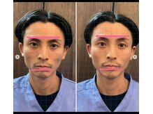 天白はら整体院アクト/リフトアップ効果も！