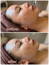 ビンナ 五反田店(Binna)/フェイスラインをシャープに