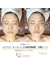 エスプリ 銀座店/本格小顔コルギ・オールハンド