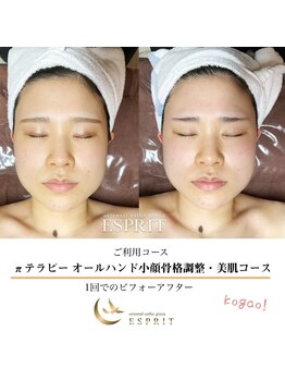 エスプリ 銀座店/本格小顔コルギ・オールハンド