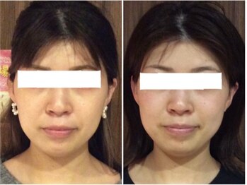 美容整体 ウェリナ 蟹江院/小顔矯正/骨盤矯正/美脚サロン