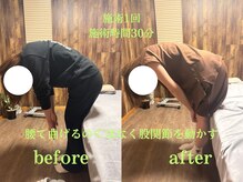 アポヨ鍼灸院(APOYO鍼灸院)/腰痛、可動域制限 before/after