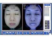 ビエル(Bielle)の雰囲気（肌の内側をみるAI肌診断今の肌悩み不安の原因ピンポイント解決！）