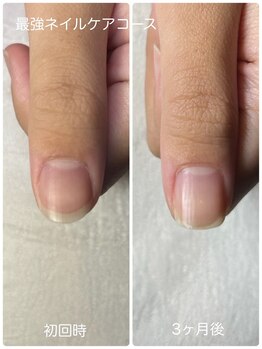 ネイルブルームーン(Nail Blue Moon)/最強ネイルケアコース