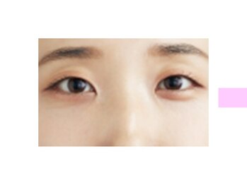 クロム アイプラス 狭山 入曽店(CHROM eye+)/まつ毛パーマでは物足りない！