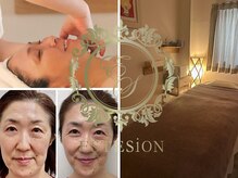 エステシオン(ESTESiON)