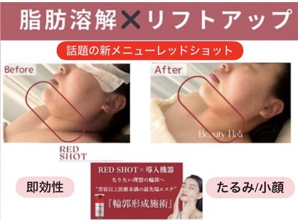 ロイヤル ビューティー サロン(Royal Beauty Saloon)の写真