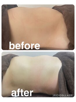 ギンザアール(GINZA R.)/ぽっこりお腹にアプローチ！