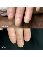 リリ(lili)/トータルハンドケア1回目