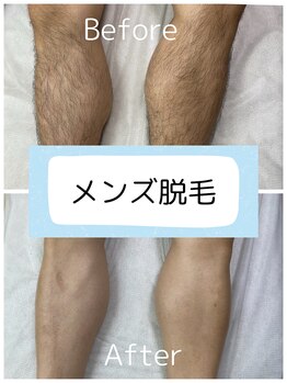 プアマヌ(PUA MANU)/メンズ脱毛も人気♪