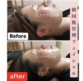エステサロン 幸