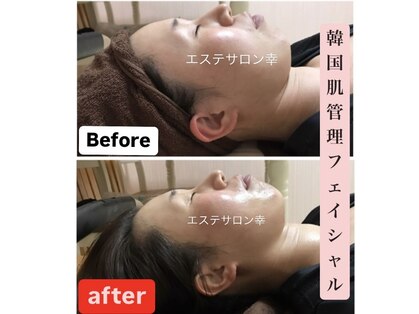エステサロン 幸の写真