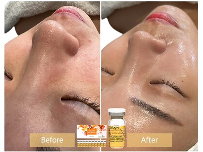 ルナビューティー 赤坂(LUNA beauty)の写真