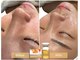 ルナビューティー 赤坂(LUNA beauty)の写真