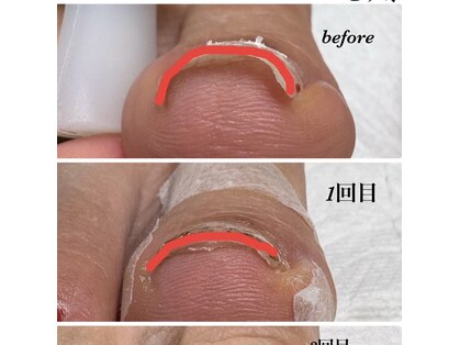 サンバイエム(#3/M)の写真