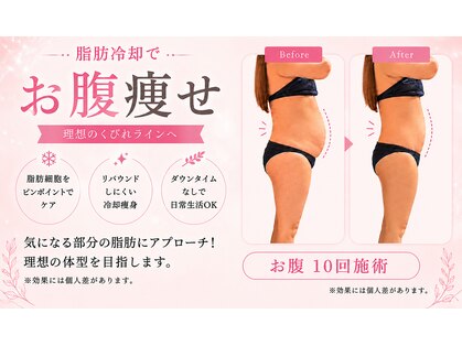 エムズビューティーサロン(M's Beauty Salon)の写真