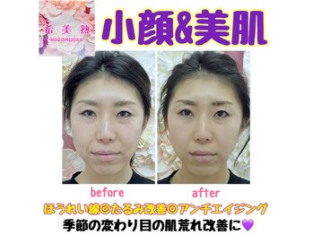 ノゾミジュク(希美熟 NOZOMIJUKU)