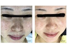 サロン バイオビオ(SALON BioBio)/