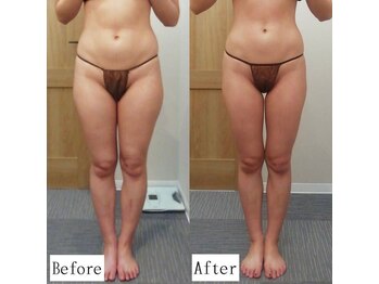 レイプラス 仙台店(RAY PLUS)/◆ビフォーアフター例のご紹介◆