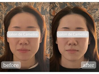 サロンドカメリア(salon de Camellia)/整体で小顔をゲット♪