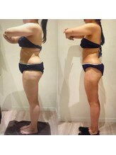 アユアランリンク 札幌中島公園店/A様：側面