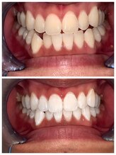 ライトビューティー 池袋店(LightBeauty)/症例写真