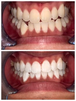 ライトビューティー 池袋店(LightBeauty)/症例写真