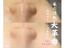 ソロリ(sorori)の雰囲気（毛穴の汚れ、つまり、黒ずみを徹底洗浄。）