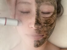 エイティ(Atey)の雰囲気（毛穴ケアでお肌の土台を作り透明感のある美肌へ！）