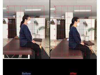 ストレチックス 近江八幡店/before/after
