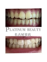 プラチナムビューティー 名古屋栄本店(PLATINUM BEAUTY)/お客様Before After