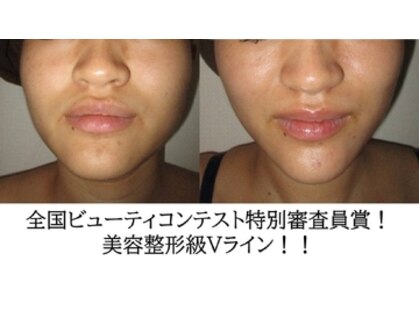 アイリスエステサロン 名護店の写真