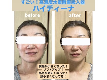 ヨサパーク フラネ(YOSA PARK Flaner)の写真