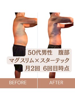 リコ 白金台(Liko)/