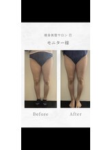 巴 松茂店/下半身コース