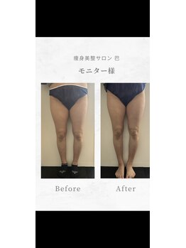 巴 松茂店/下半身コース